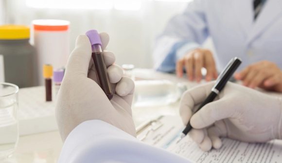 Doctor holding a bottle of blood sample in lab. science and medical concept